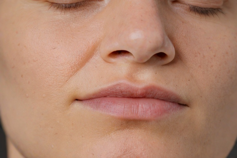 Seborrheic Dermatitis Malassezia Suppression: Zinc Pyrithione Comparisons in Clinical Acne Vulgaris Sebum Reduction Formulations