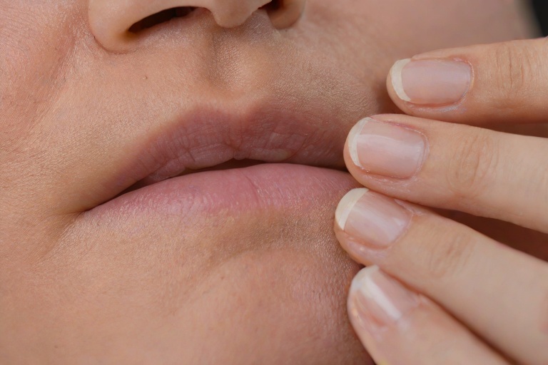 Contact Dermatitis Patch Testing: Evaluating Allergic Sensitization Risks in Clinical Antifungal Onychomycosis Solutions